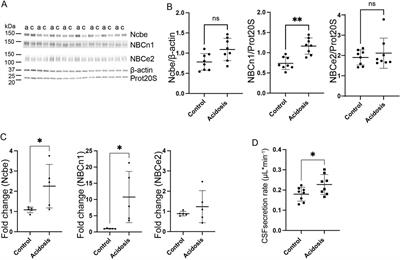 NH4Cl-induced metabolic acidosis increases the abundance of HCO3− transporters in the choroid plexus of mice